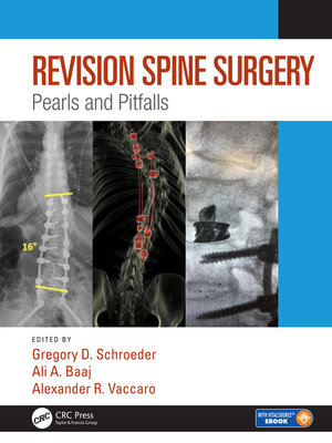 cover image of Revision Spine Surgery